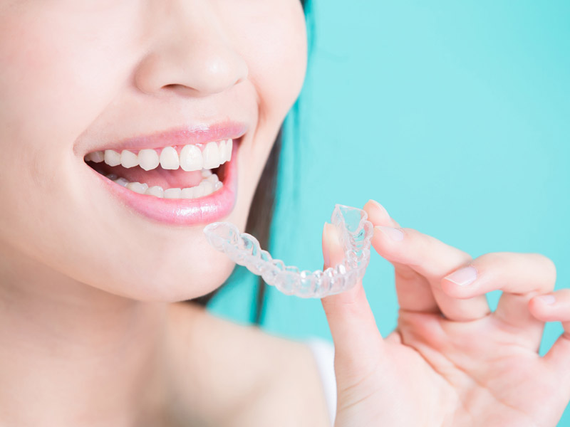 invisalign in lethbridge