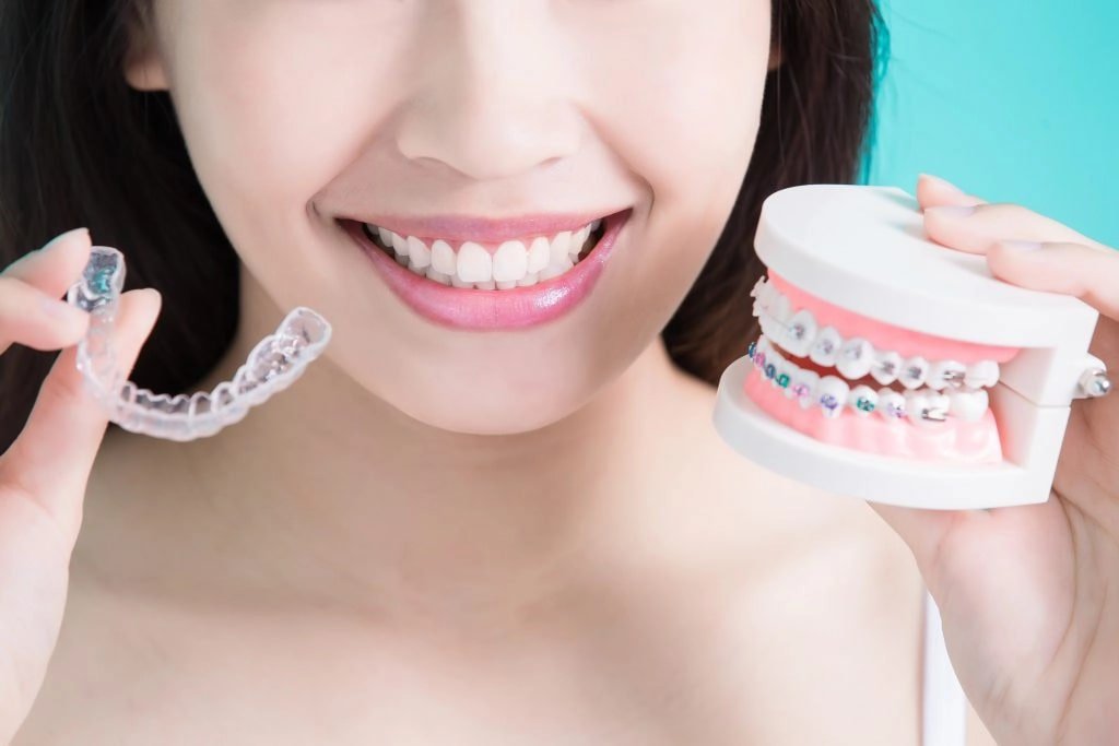 choosing invisalign for adults