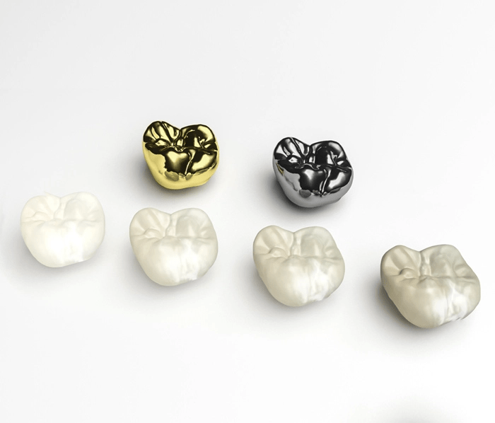 dental crowns in lethbridge