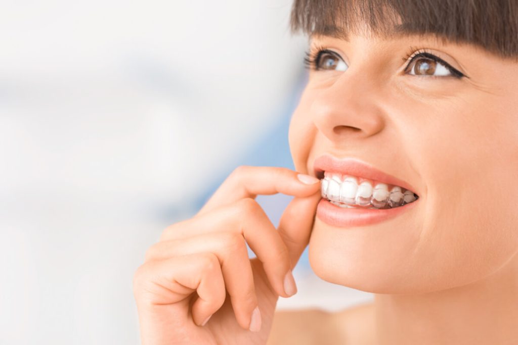 can invisalign make your smile wider and bigger