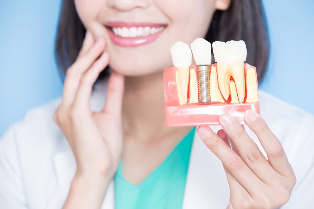 overlooked advantages of dental implants you should know about