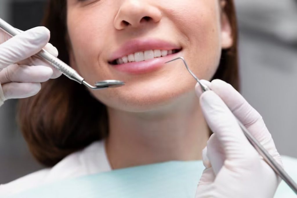 what you should know about dental bonding before and after