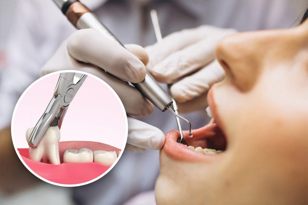 faster healing after tooth extractions